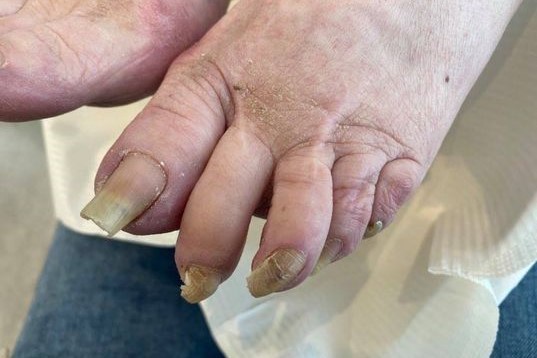 Medische voetverzorging